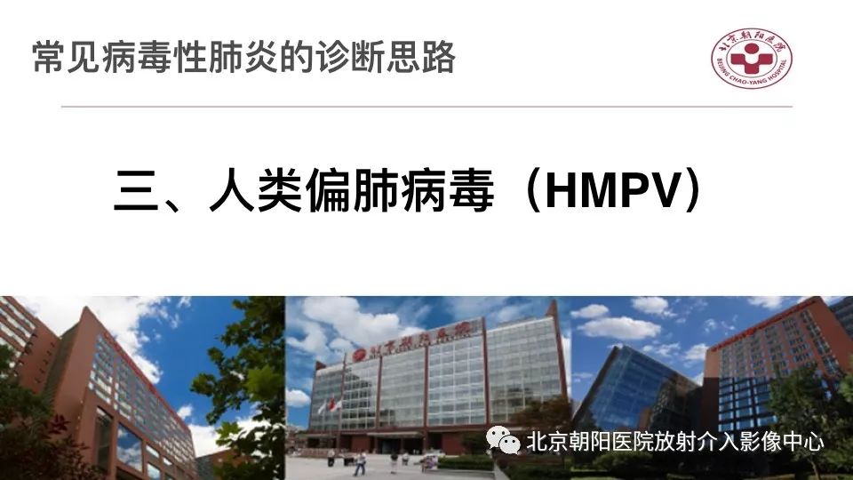 【PPT】病毒性肺炎影像诊断思路