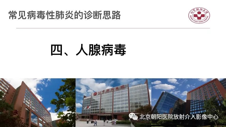 【PPT】病毒性肺炎影像诊断思路