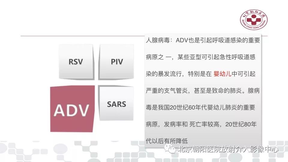【PPT】病毒性肺炎影像诊断思路