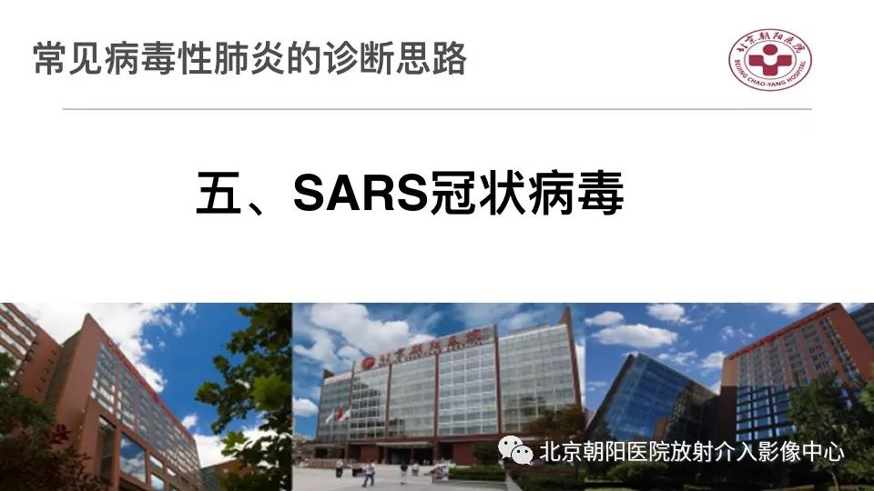 【PPT】病毒性肺炎影像诊断思路