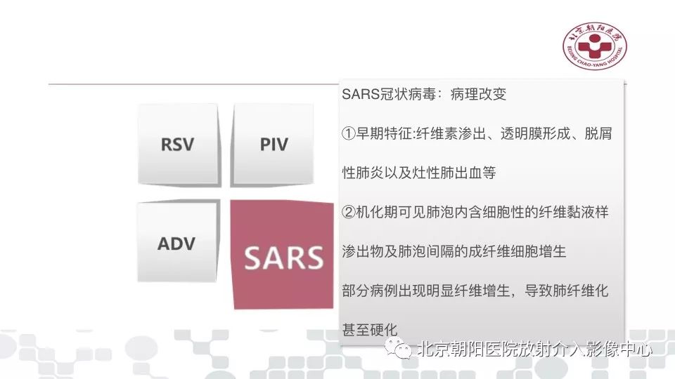 【PPT】病毒性肺炎影像诊断思路