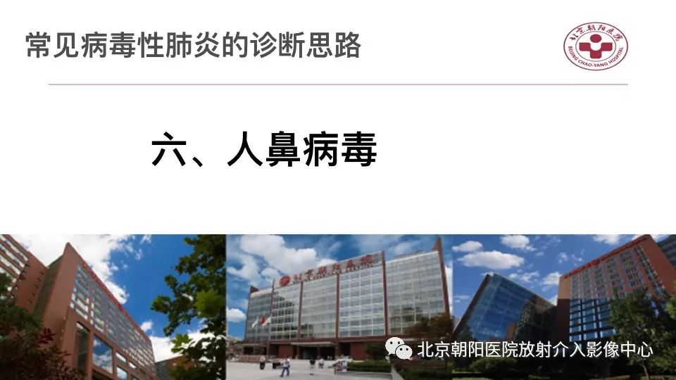 【PPT】病毒性肺炎影像诊断思路