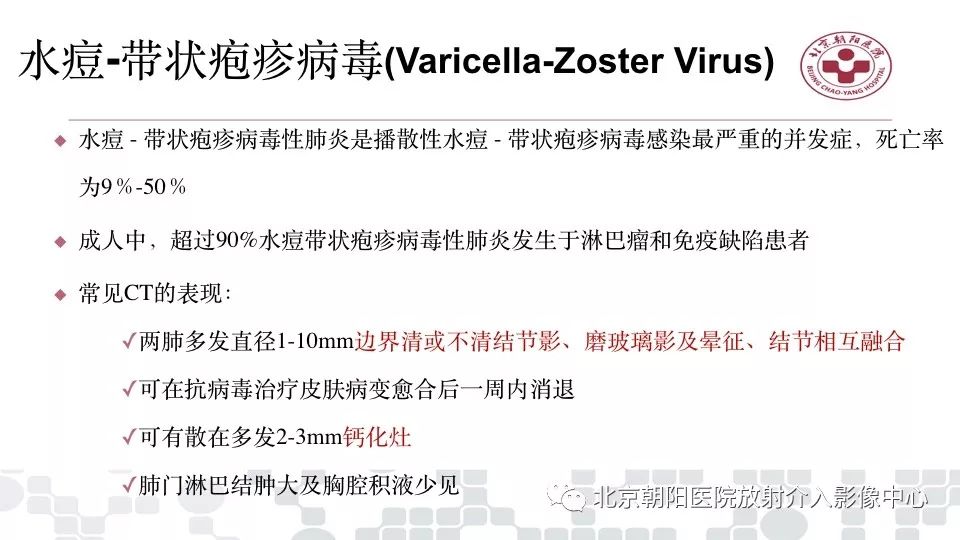 【PPT】病毒性肺炎影像诊断思路