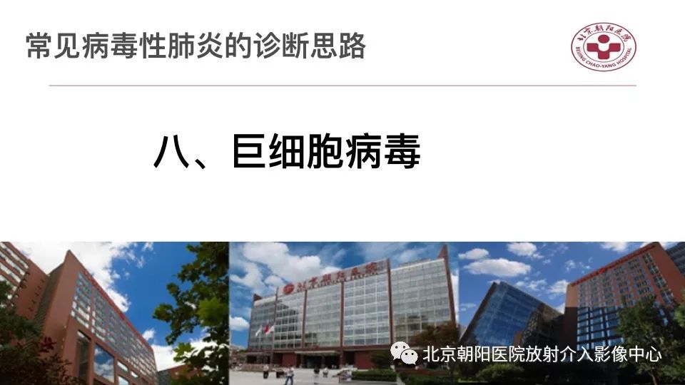 【PPT】病毒性肺炎影像诊断思路