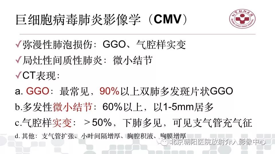 【PPT】病毒性肺炎影像诊断思路