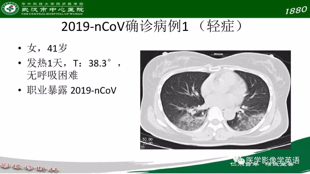 【PPT】易被忽视的疑似2019-nCoV病毒性肺炎