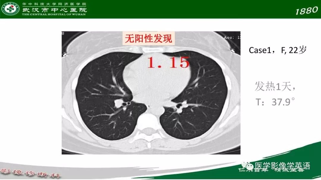 【PPT】易被忽视的疑似2019-nCoV病毒性肺炎