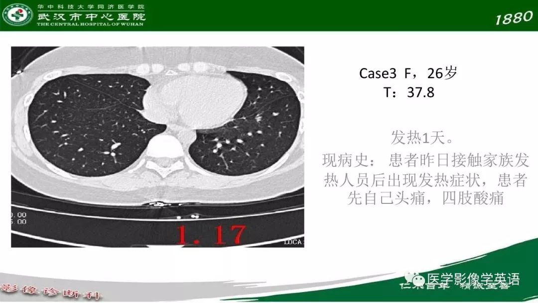 【PPT】易被忽视的疑似2019-nCoV病毒性肺炎