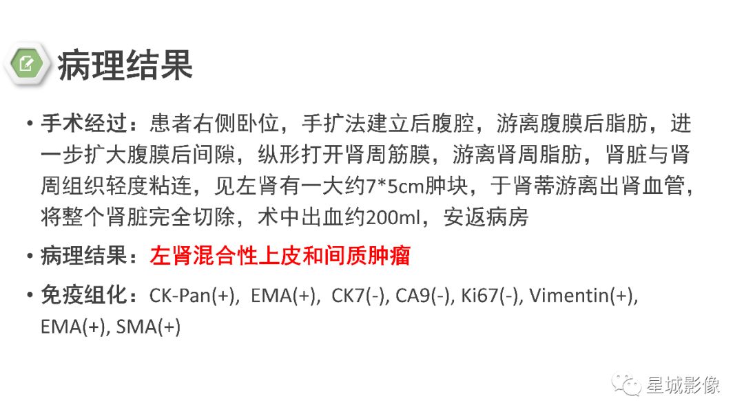 【PPT】肾混合性上皮和间质肿瘤