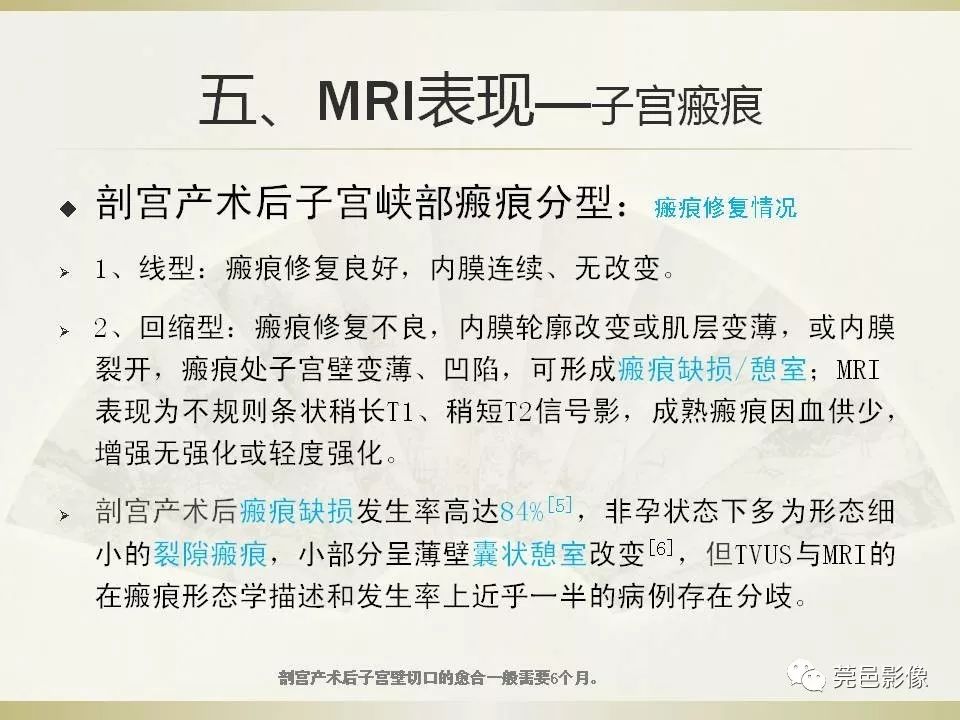【PPT】剖宫产术后子宫瘢痕妊娠MRI诊断