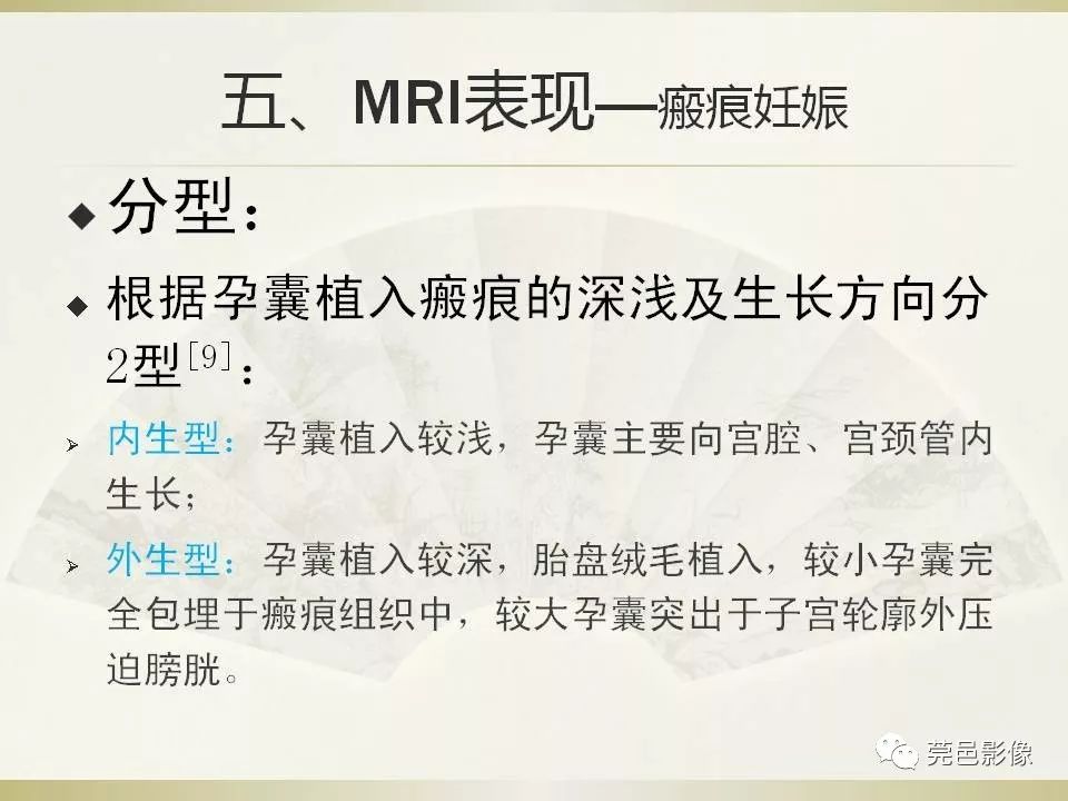 【PPT】剖宫产术后子宫瘢痕妊娠MRI诊断