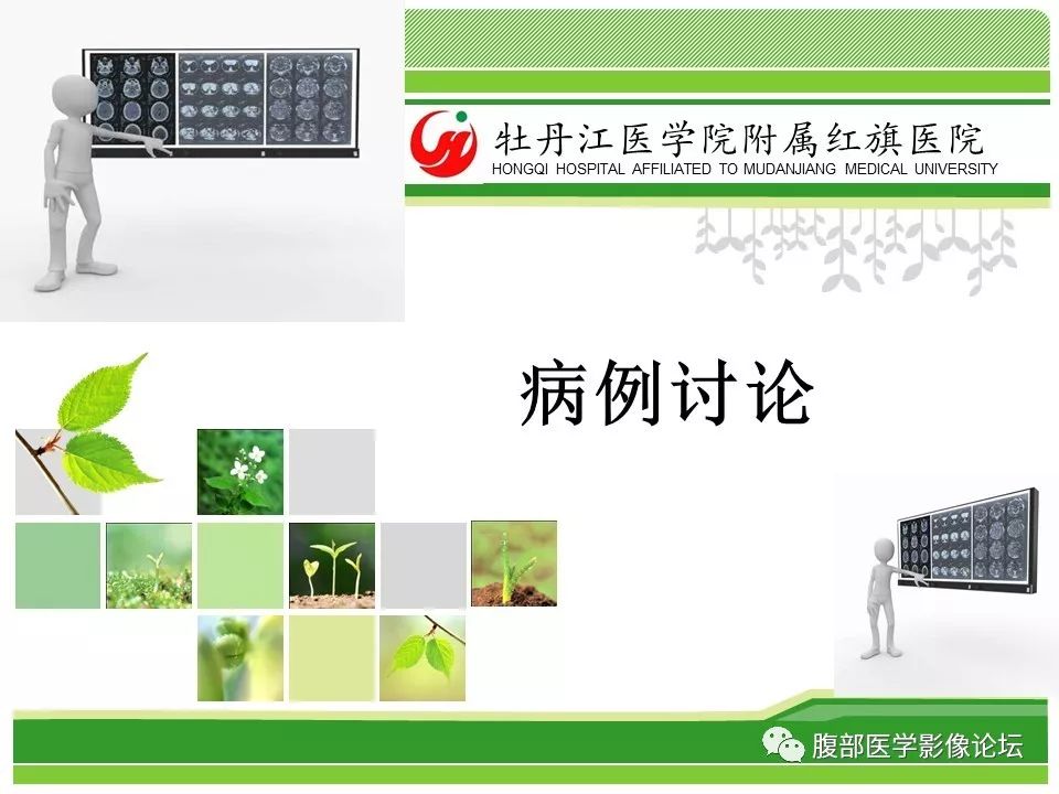 【病例】肝脏局限性慢性炎症1例MR影像