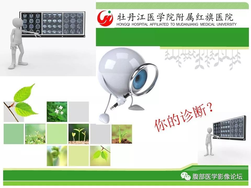 【病例】肝脏局限性慢性炎症1例MR影像