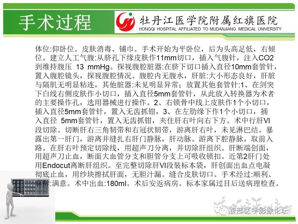 【病例】肝脏局限性慢性炎症1例MR影像