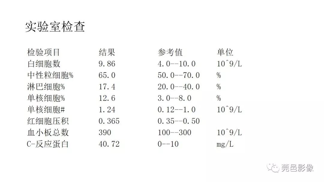 【PPT】肠道淋巴瘤CT诊断