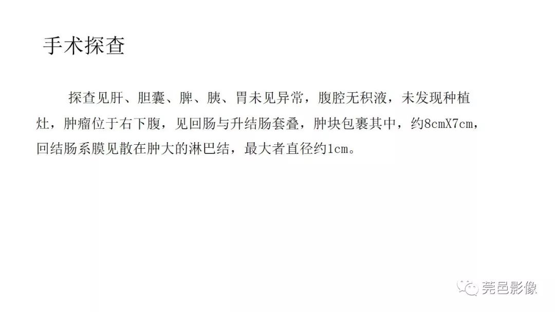 【PPT】肠道淋巴瘤CT诊断