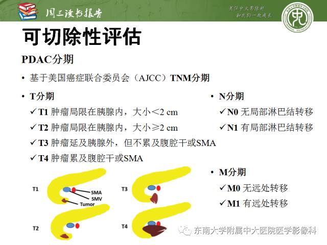 【PPT】多排螺旋CT评价胰腺导管腺癌中肿瘤与血管的关系：不同分期系统及其对治疗的影响