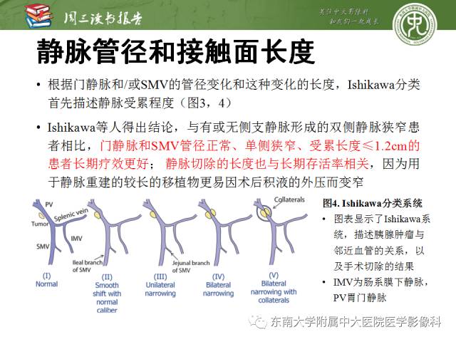【PPT】多排螺旋CT评价胰腺导管腺癌中肿瘤与血管的关系：不同分期系统及其对治疗的影响