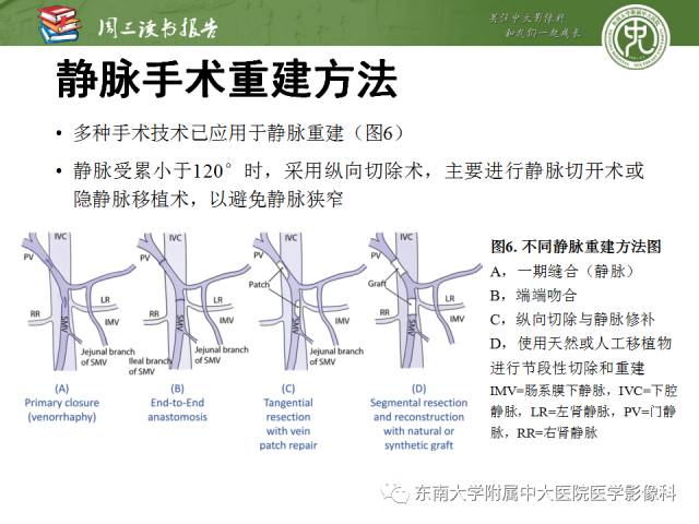 【PPT】多排螺旋CT评价胰腺导管腺癌中肿瘤与血管的关系：不同分期系统及其对治疗的影响