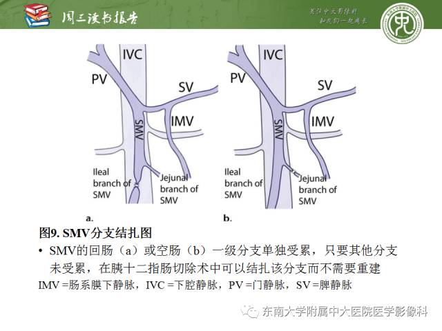 【PPT】多排螺旋CT评价胰腺导管腺癌中肿瘤与血管的关系：不同分期系统及其对治疗的影响