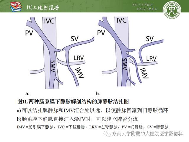 【PPT】多排螺旋CT评价胰腺导管腺癌中肿瘤与血管的关系：不同分期系统及其对治疗的影响