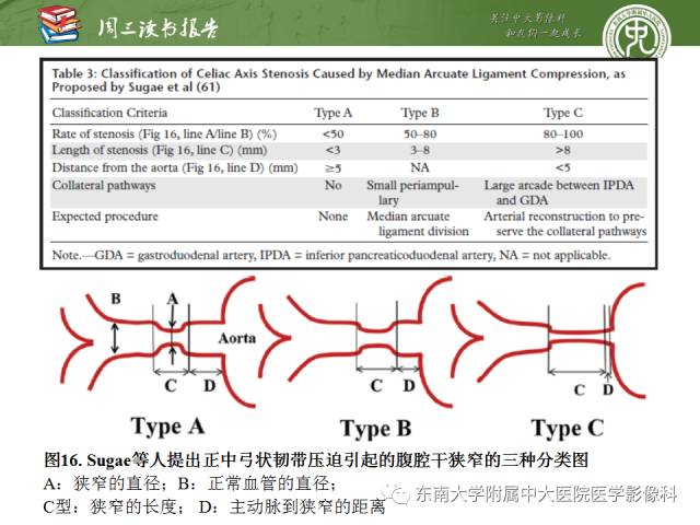 【PPT】多排螺旋CT评价胰腺导管腺癌中肿瘤与血管的关系：不同分期系统及其对治疗的影响