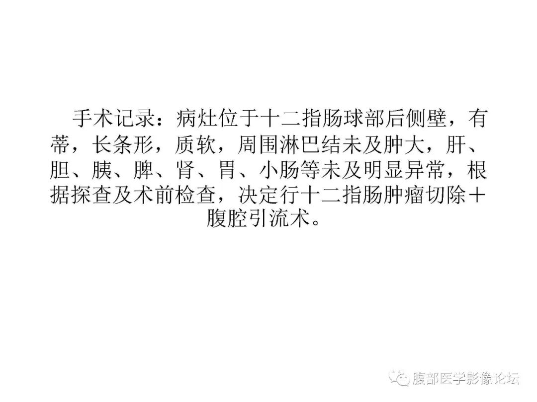 【病例】十二指肠布氏腺错构瘤1例CT影像