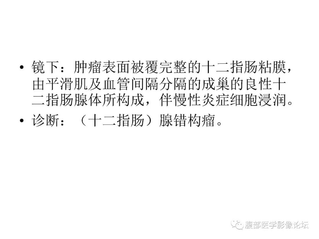 【病例】十二指肠布氏腺错构瘤1例CT影像