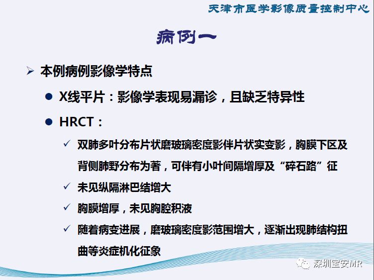 【PPT】新型冠状病毒感染肺炎影像学表现—阶段性总结