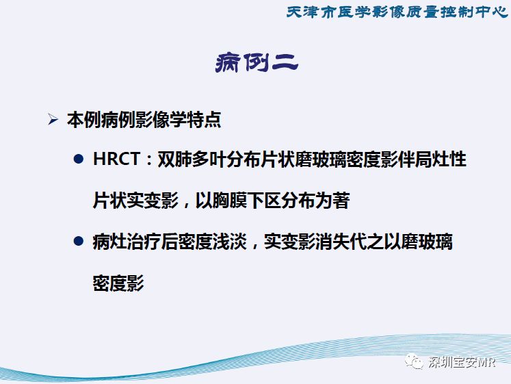 【PPT】新型冠状病毒感染肺炎影像学表现—阶段性总结