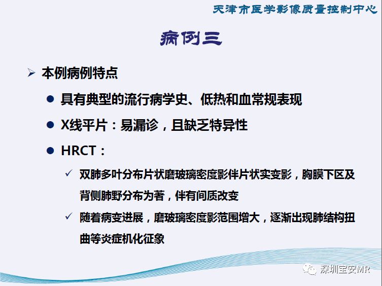【PPT】新型冠状病毒感染肺炎影像学表现—阶段性总结