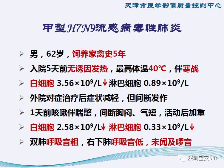 【PPT】新型冠状病毒感染肺炎影像学表现—阶段性总结