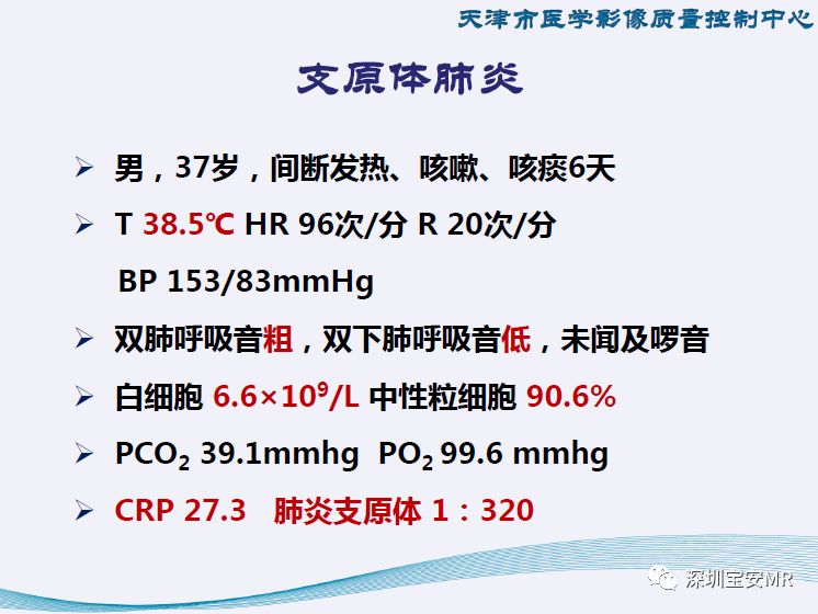 【PPT】新型冠状病毒感染肺炎影像学表现—阶段性总结