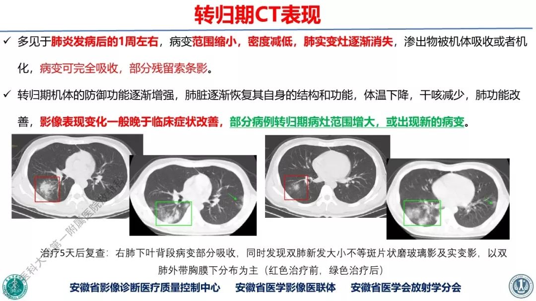 【PPT】新型冠状病毒肺炎影像学诊断