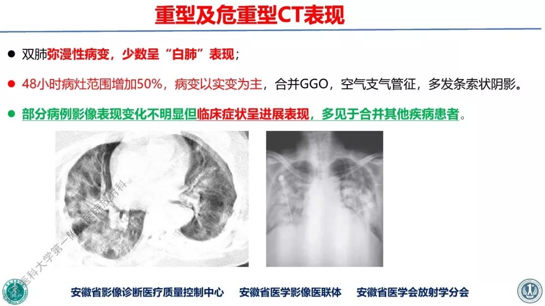 【PPT】新型冠状病毒肺炎影像学诊断