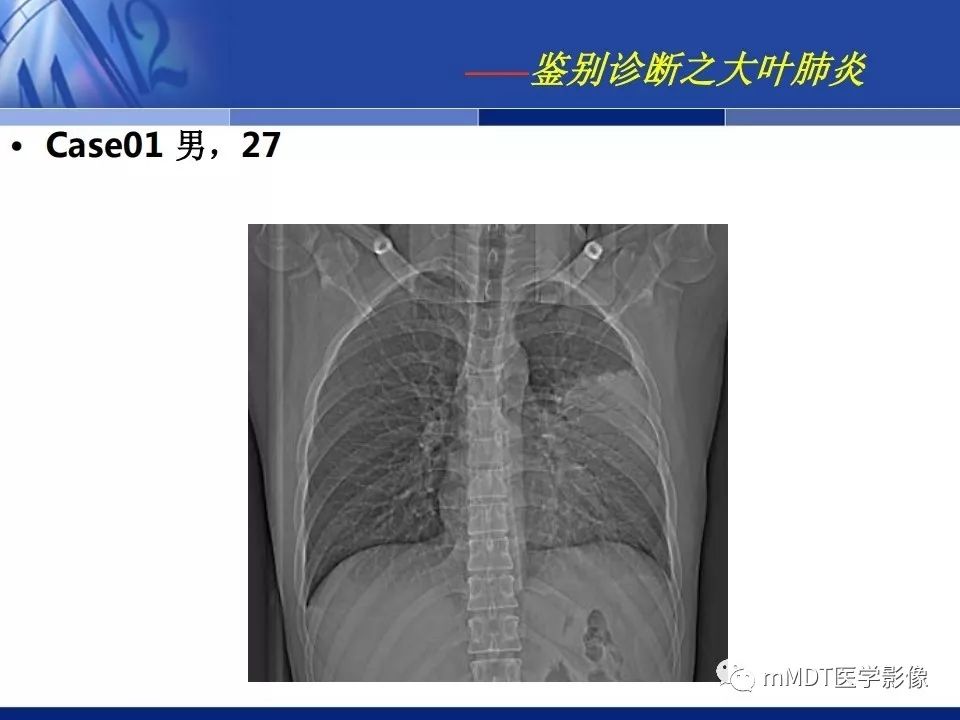 【PPT】新型冠状病毒肺炎的诊断与鉴别诊断