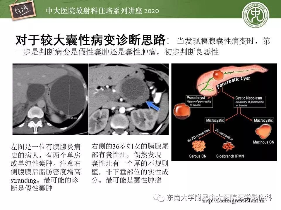 【PPT】胰腺良恶性病变的影像分析思路