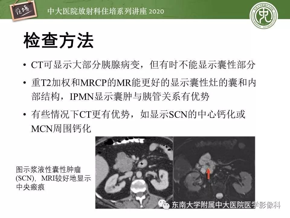 【PPT】胰腺良恶性病变的影像分析思路