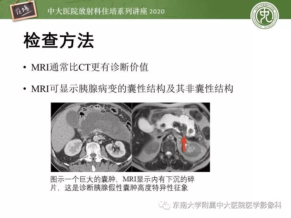 【PPT】胰腺良恶性病变的影像分析思路