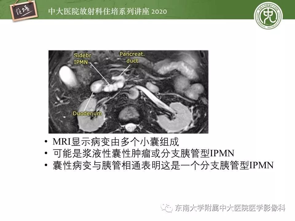 【PPT】胰腺良恶性病变的影像分析思路