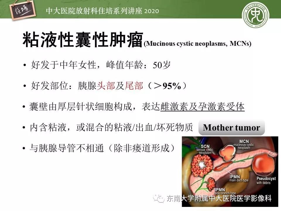 【PPT】胰腺良恶性病变的影像分析思路