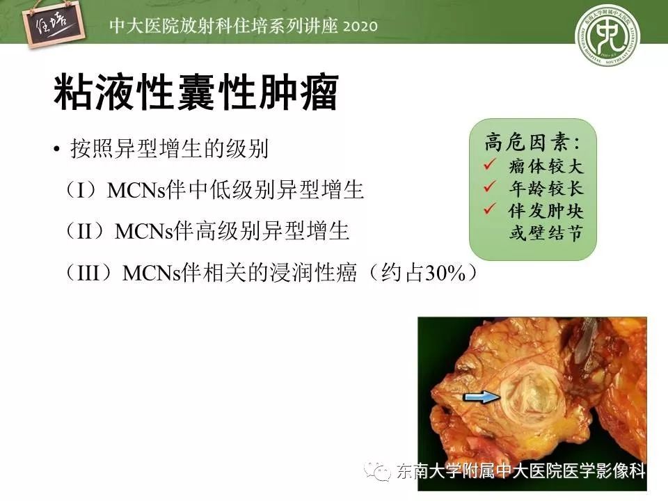 【PPT】胰腺良恶性病变的影像分析思路
