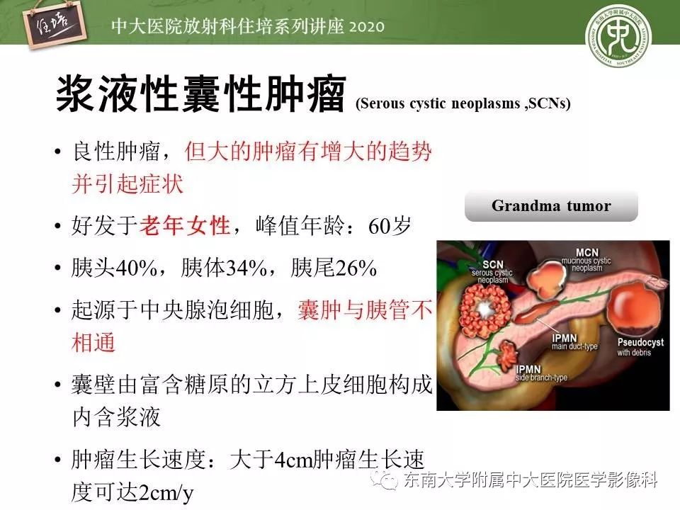 【PPT】胰腺良恶性病变的影像分析思路