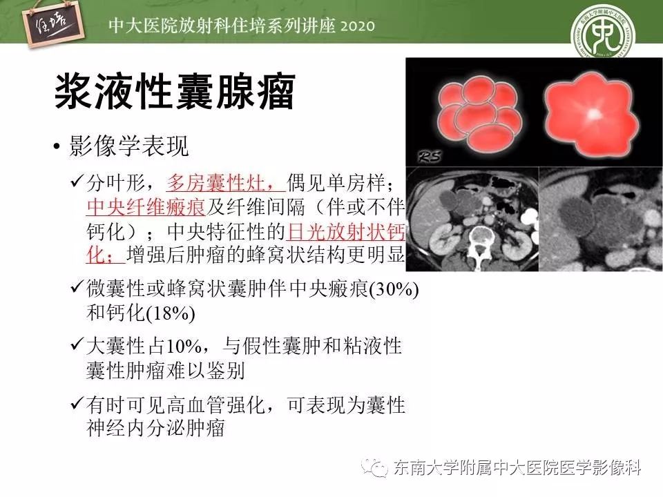 【PPT】胰腺良恶性病变的影像分析思路