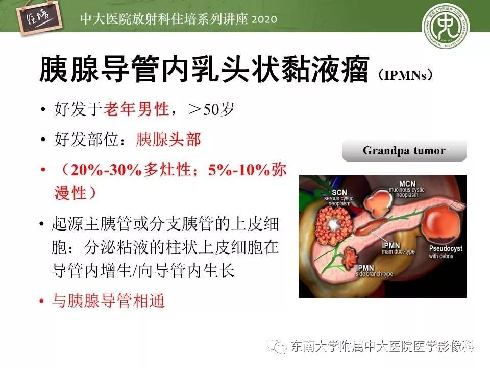 【PPT】胰腺良恶性病变的影像分析思路