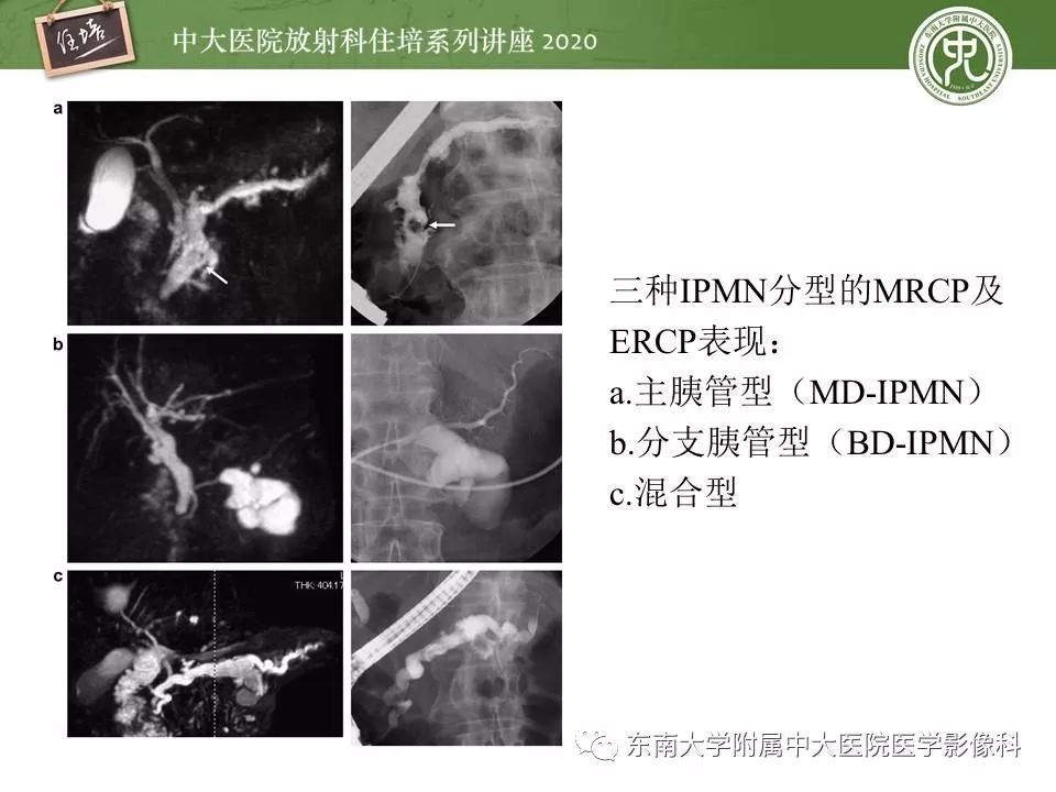 【PPT】胰腺良恶性病变的影像分析思路