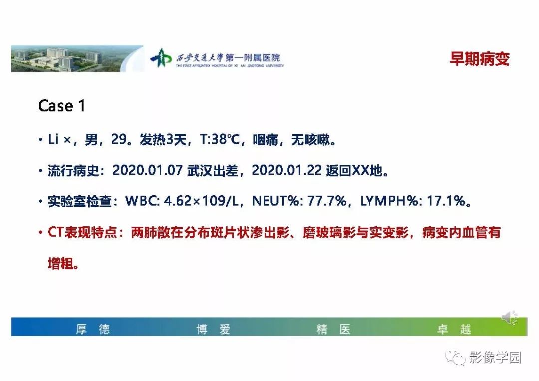 【PPT】输入性新冠肺炎的影像学特点与识别