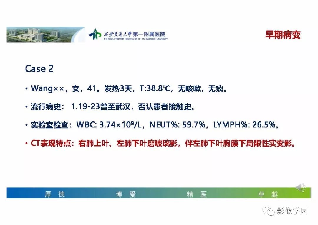【PPT】输入性新冠肺炎的影像学特点与识别