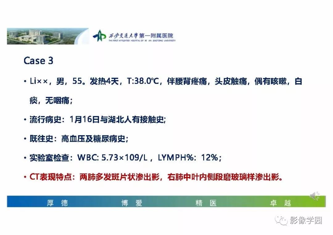 【PPT】输入性新冠肺炎的影像学特点与识别
