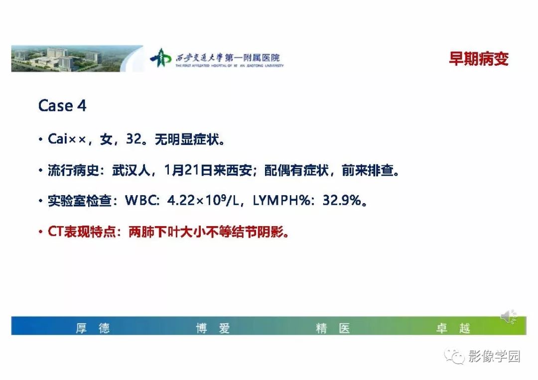 【PPT】输入性新冠肺炎的影像学特点与识别